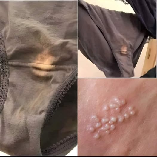 If you find this in your underwear,