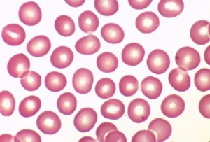 Is 120/80 A Normal Blood Pressure? The Answer Is Surprising