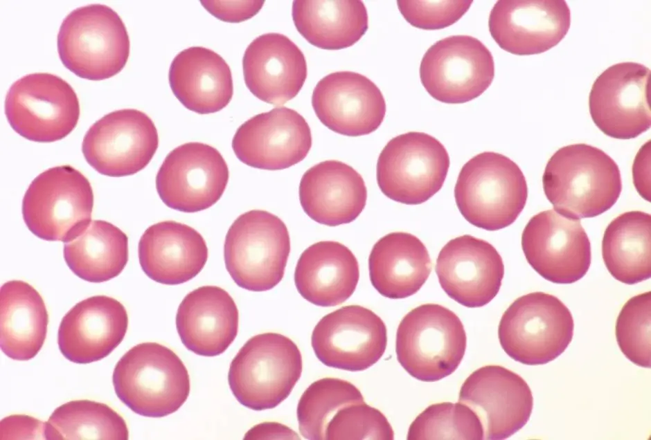 Is 120/80 A Normal Blood Pressure? The Answer Is Surprising