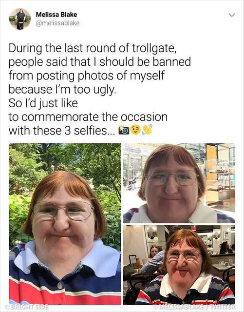 Bullied woman ‘too ugly’ for selfies takes one a day for a year