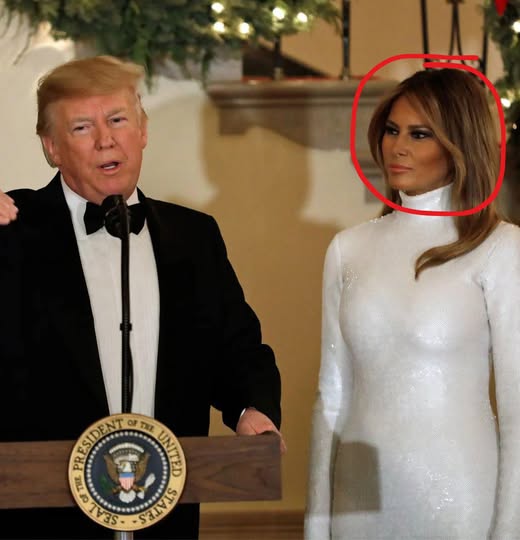Melania Trump Sparks Cosmetic Surgery Rumors