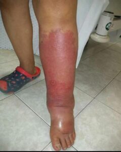 Signs on your FEET that indicate he is cr… see more