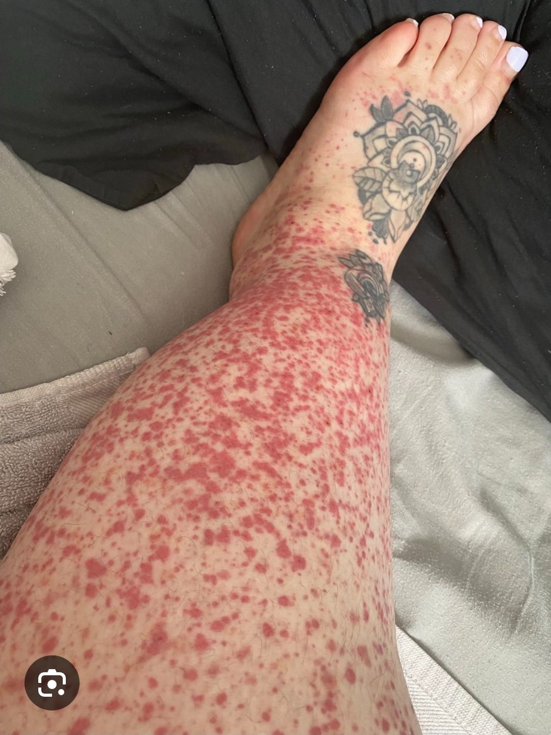 These are the first symptoms of cr … See more