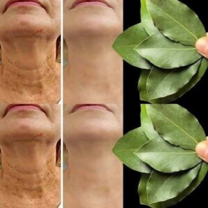 Bay Leaf Is 100,000 Times Stronger Than Botox? | Natural Wrinkle Eraser Even at Age 70!