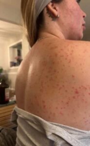 These are the consequences of sleeping with…See more