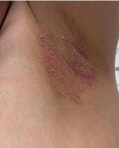 These are the first symptoms of cr … See more