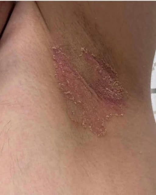 These are the first symptoms of cr … See more