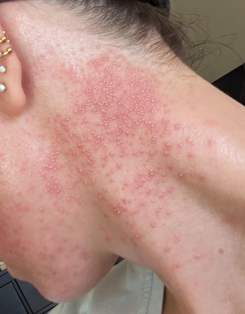 These are the consequences of eating …See more