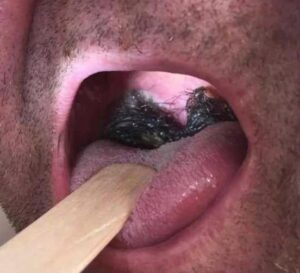 These are the consequences of eating …See more