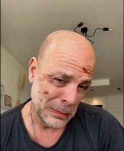 Bruce Willis Was Diagnosed With Frontotemporal Dementia
