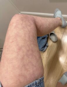 These are the consequences of sleeping with the…
