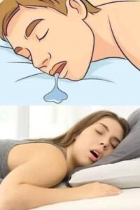 If you drool while