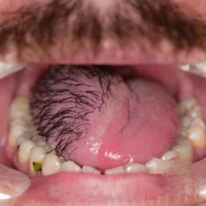Skip to content Teknolojibura MENU These are the consequences of sleeping with…See more