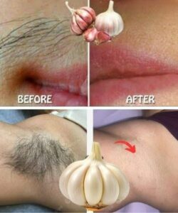 How Garlic Works Wonders for Hair Removal: A Complete Guide