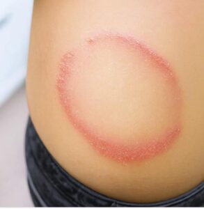 These are the first symptoms of cr … See more
