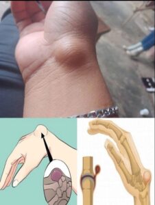 This lump may appear because of something you do every day… See more