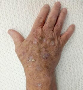 ATTENTION to these first signs of…