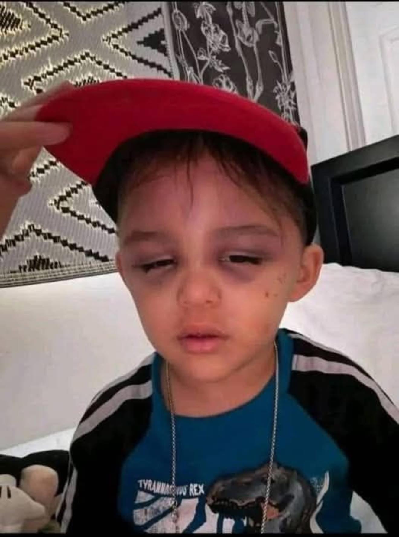 A 3-year-old boy was found 1 hour
