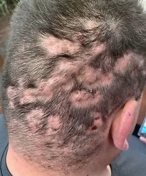 Early warninGg signs: Ssigns that your health is at risk