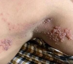01These are the consequences of sleeping with the…See more
