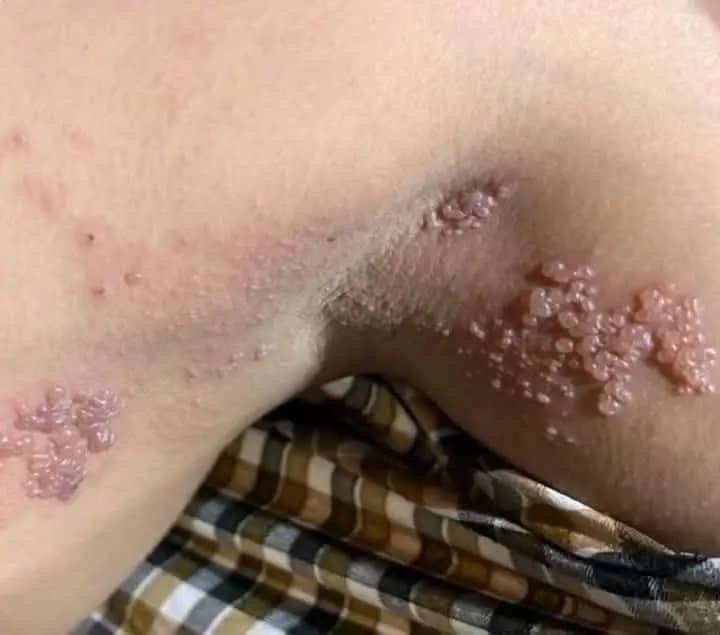 01These are the consequences of sleeping with the…See more