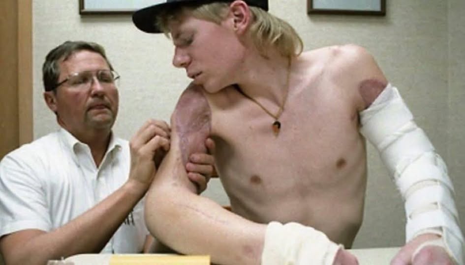 How John Thompson Survived Losing Both of His Arms