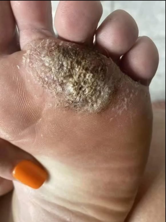 BE VERY CAREFUL . If you get this, you are infected with …. See more