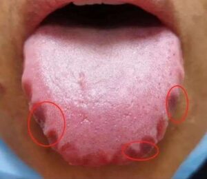 These Are The First Symptoms Of A…