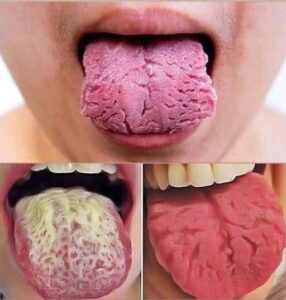 These are the consequences of sleeping with the… See more