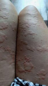 The Shocking Consequences of Sleeping With the…See more