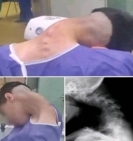 Young man hospitalized because he dropped his ca… See more