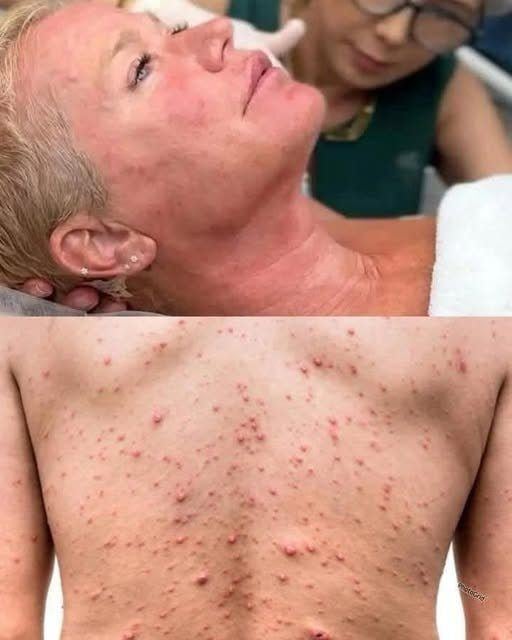 These are the consequences of sleeping co… See more