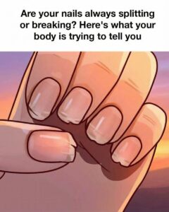 Why Nails May Change in Strength and Texture as Time Goes On