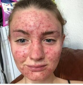 Her Body Was Itchy, He Thought It Was An Allergy
